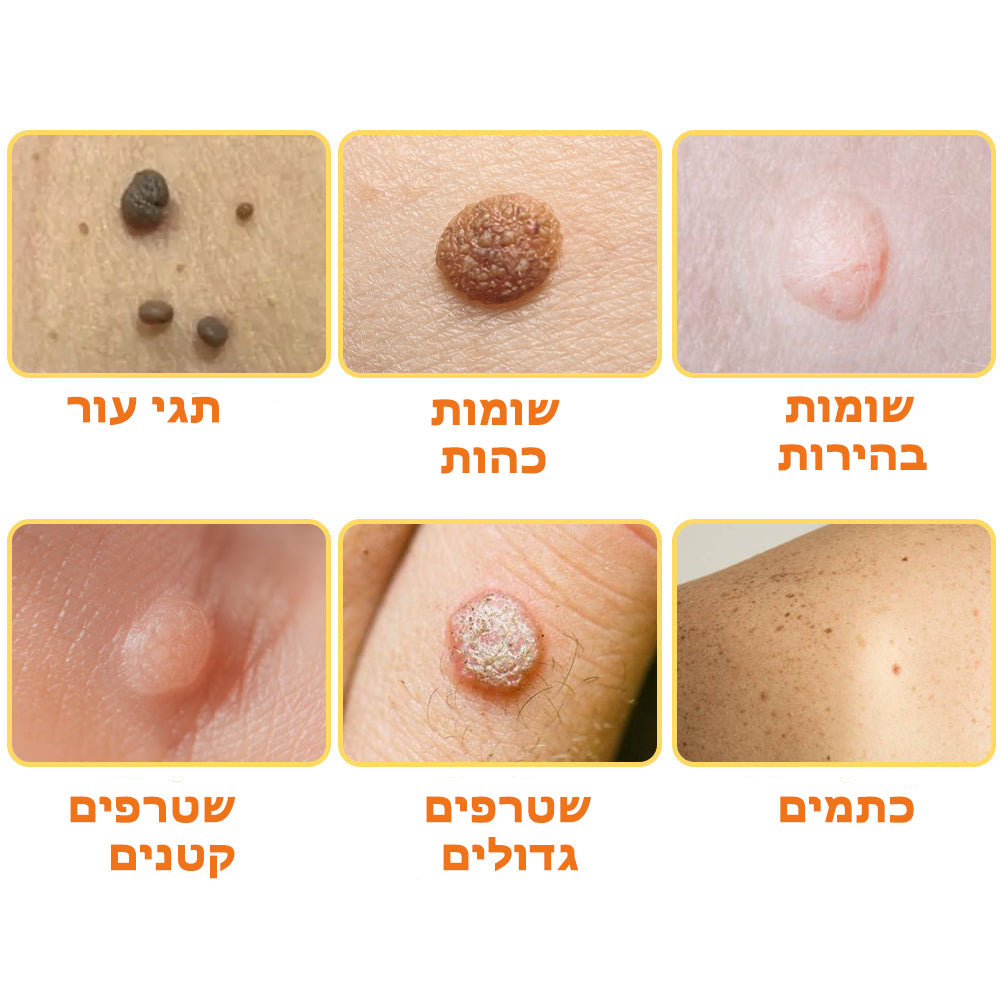 BeeWell | מקל על בעיות עור תוך שבוע בלבד!