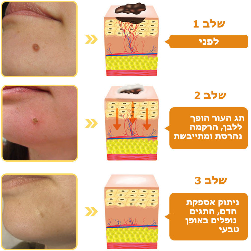 BeeWell | מקל על בעיות עור תוך שבוע בלבד!