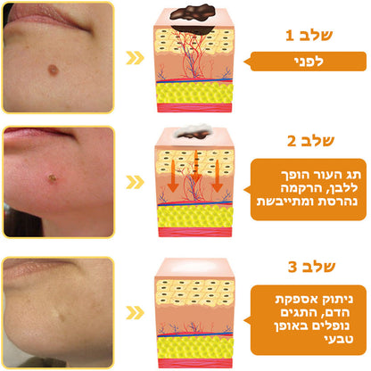 BeeWell | מקל על בעיות עור תוך שבוע בלבד!