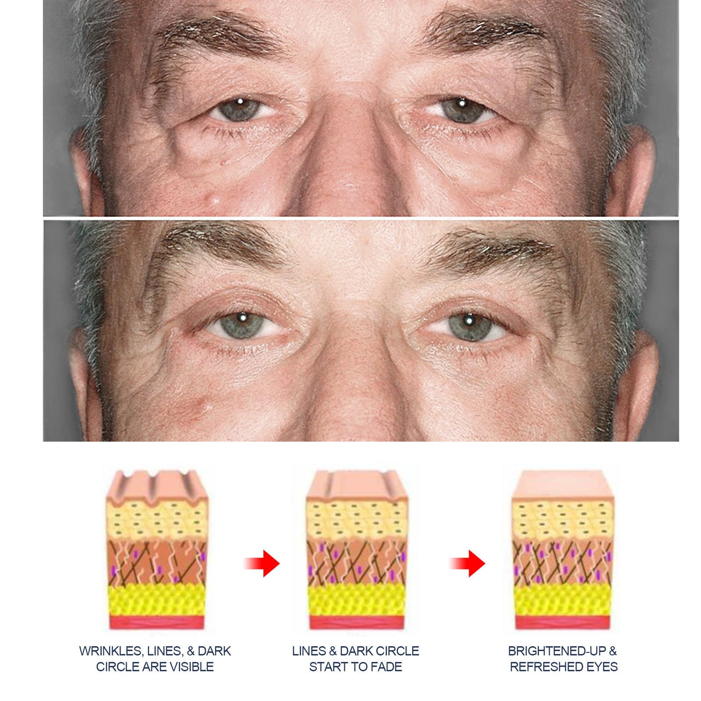 EyeRevive מורכב להדוק עור העיניים