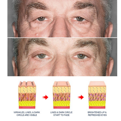 EyeRevive מורכב להדוק עור העיניים